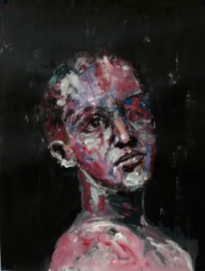 Portrait d'un jeune homme/femme en borgne de l'oeil droit sur fond sombre. Peinture acrylique sur papier, par Stanmac.