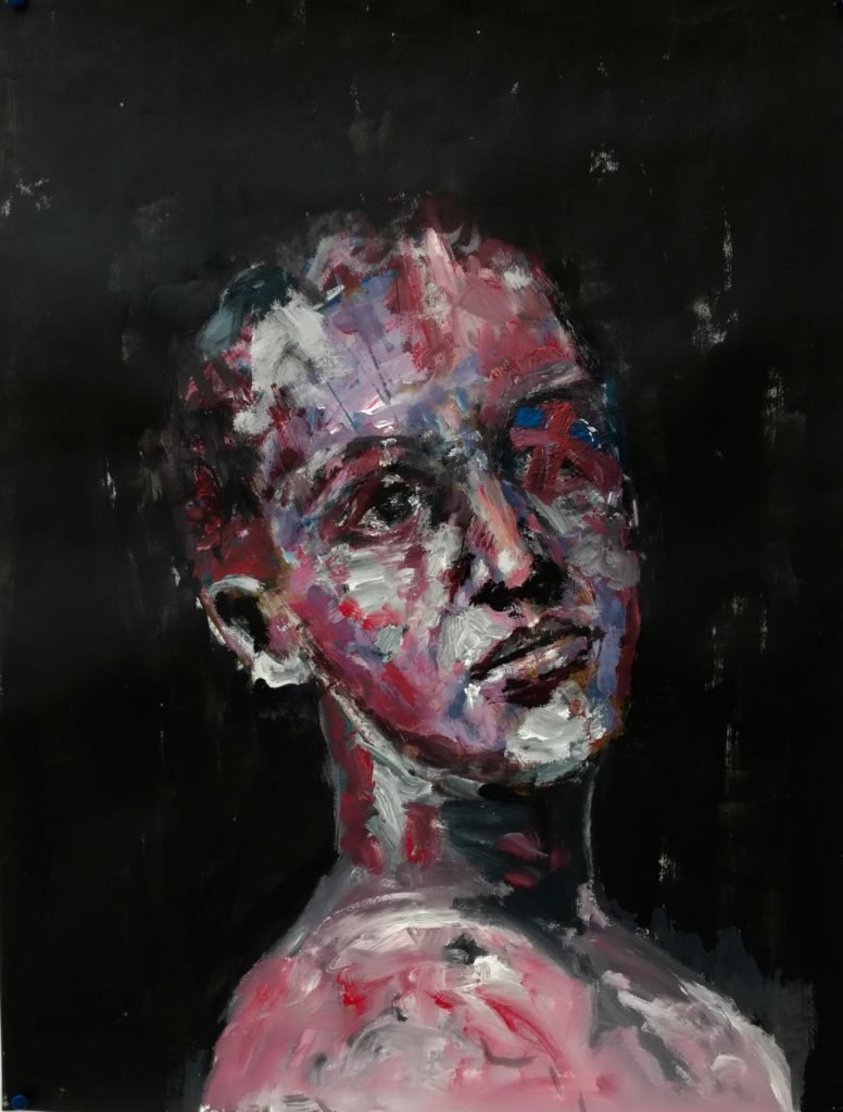 Portrait d'un jeune homme/femme en borgne de l'oeil droit sur fond sombre. Peinture acrylique sur papier, par Stanmac.